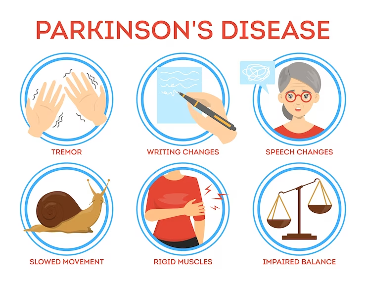 common symptoms of Parkinson's disease