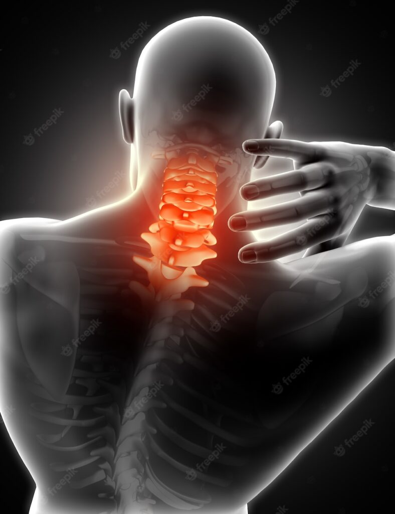 cervical spondylosis neck pain