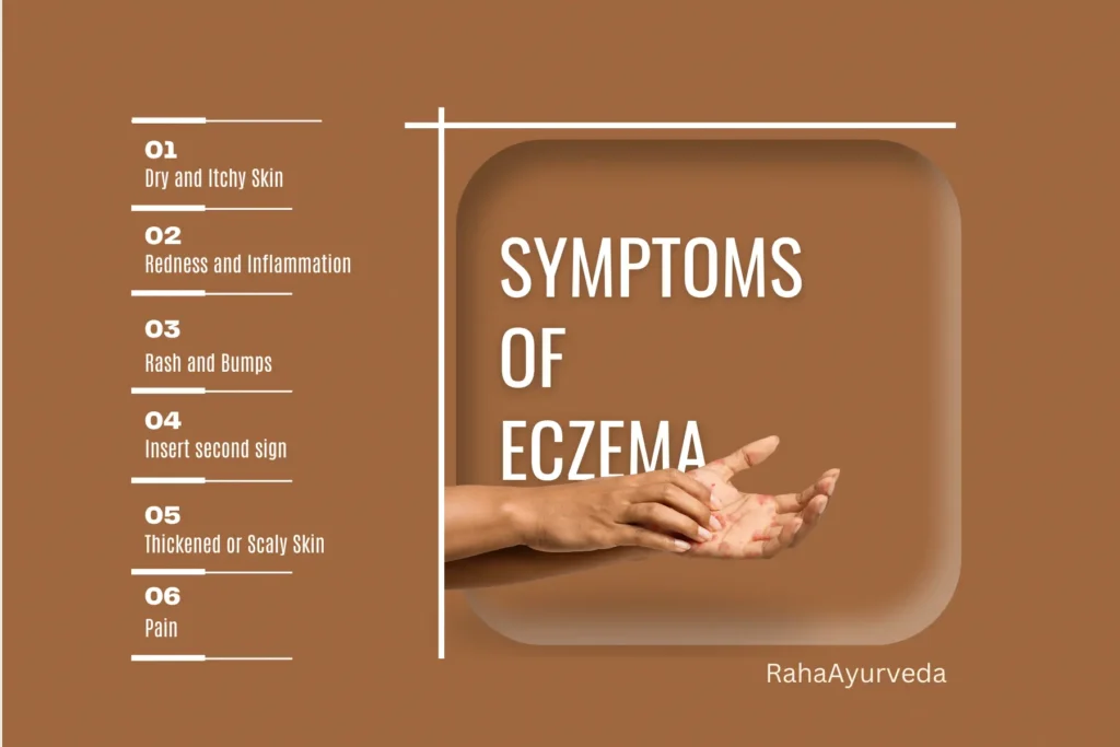 major symptoms of eczema